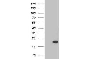 Western Blotting (WB) image for anti-Crystallin, alpha B (CRYAB) antibody (ABIN2715989) (CRYAB 抗体)