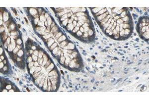 ABIN6273041 at 1/100 staining Rat colon tissue by IHC-P. (DIAPH3 抗体  (Internal Region))