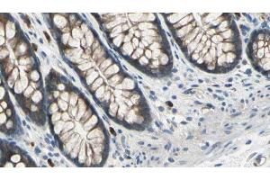 ABIN6273041 at 1/100 staining Rat colon tissue by IHC-P.