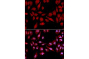 Immunofluorescence analysis of U2OS cells using PSMA2 antibody (ABIN5971338). (PSMA2 抗体)