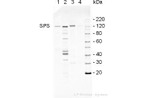 Western Blotting (WB) image for anti-SPS antibody (ABIN5706929) (SPS 抗体)