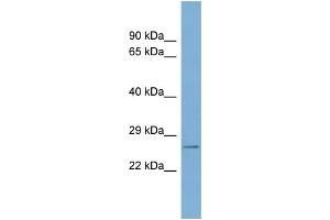 WB Suggested Anti-WBP2 Antibody Titration: 0. (WBP2 抗体  (N-Term))