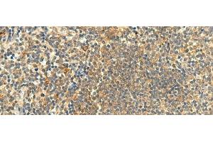 Immunohistochemistry of paraffin-embedded Human tonsil tissue using CLEC4D Polyclonal Antibody at dilution of 1:50(x200) (CLEC4D 抗体)