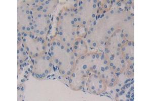 Used in DAB staining on fromalin fixed paraffin- embedded kidney tissue (Secernin 1 抗体  (AA 2-414))