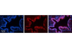 Rabbit Anti-SQLE Antibody     Formalin Fixed Paraffin Embedded Tissue: Human Bronchial Epithelial Tissue  Observed Staining: Cytoplasmic  Primary Antibody Concentration: 1:100  Other Working Concentrations: 1/600  Secondary Antibody: Donkey anti-Rabbit-Cy3  Secondary Antibody Concentration: 1:200  Magnification: 20X  Exposure Time: 0. (SQLE 抗体  (C-Term))