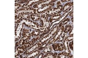 Immunohistochemical staining of human kidney with TIMM10 polyclonal antibody  shows strong cytoplasmic positivity in cells in tubules at 1:50-1:200 dilution. (TIMM10 抗体)