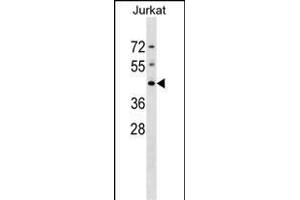 DHPS Antibody (N-term) (ABIN1539082 and ABIN2848705) western blot analysis in Jurkat cell line lysates (35 μg/lane). (DHPS 抗体  (N-Term))