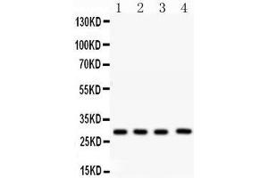 Western Blotting (WB) image for anti-Carbonic Anhydrase I (CA1) (AA 9-261) antibody (ABIN3043766) (CA1 抗体  (AA 9-261))
