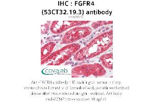 Image no. 1 for anti-Fibroblast Growth Factor Receptor 4 (FGFR4) antibody (ABIN2851987) (FGFR4 抗体)