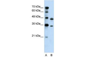 PRPS2 antibody used at 0. (PRPS2 抗体  (Middle Region))