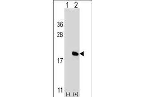 Western blot analysis of IL17A (arrow) using rabbit polyclonal IL17A Antibody (Center) (ABIN656842 and ABIN2846049). (Interleukin 17a 抗体  (AA 61-87))