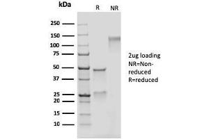 SDS-PAGE Analysis Purified Adipophilin Recombinant Mouse Monoclonal Antibody (rADFP/1493). (Recombinant ADRP 抗体  (AA 249-376))