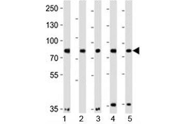 INSRR Antikörper  (AA 668-702)