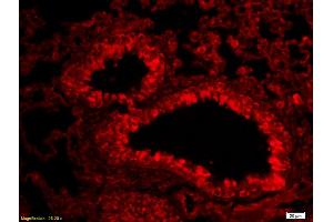 Formalin-fixed and paraffin-embedded rat lung labeled with Anti-Aggrecan Polyclonal Antibody, Unconjugated (ABIN1386175) 1:200, overnight at 4°C, The secondary antibody was Goat Anti-Rabbit IgG, Cy3 conjugated used at 1:200 dilution for 40 minutes at 37°C. (Aggrecan 抗体  (AA 601-700))