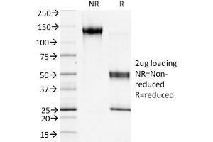 SDS-PAGE Analysis Purified S100A4 Mouse Monoclonal Antibody (S100A4/1481).