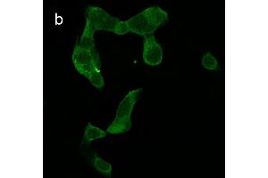 Detection of cathepsin B (CB) activity in Eca-109 cells by the CB probe. (山羊 anti-兔 IgG Antibody (FITC))