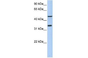 PIP3-E antibody used at 1 ug/ml to detect target protein. (ICEF1 抗体  (Middle Region))