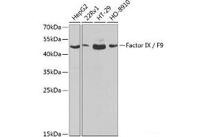 Western blot analysis of extracts of various cell lines using Factor IX / F9 Polyclonal Antibody at dilution of 1:1000. (Coagulation Factor IX 抗体)