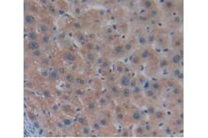 DAB staining on IHC-P; Samples: Human Liver Tissue (MSTN 抗体  (AA 267-375))