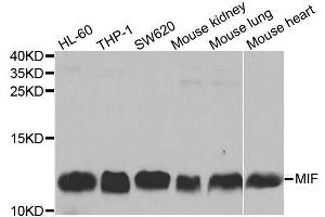 Western blot analysis of extracts of various cell lines, using MIF antibody. (MIF 抗体  (AA 1-115))