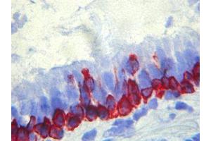 Immunohistochemistry (IHC) image for anti-Basal Membrane antibody (ABIN781795) (Basal Membrane 抗体)