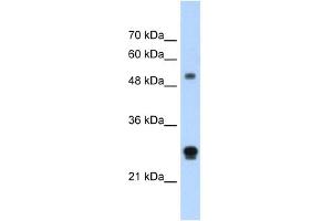 WB Suggested Anti-IGSF1 Antibody Titration:  1. (IGSF1 抗体  (N-Term))