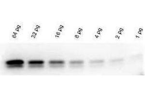 Chemiluminescent Western Blot Kit shows super sensitive signal. (Western Blot Kit Chemiluminescent Western Blot Kit for use with Human Primary Antibody FemtoMax)