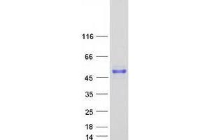 Western Blotting (WB) image for Melanoma Antigen Family A, 3 (MAGEA3) protein (Myc-DYKDDDDK Tag) (ABIN2725171)