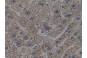 Detection of APAF1 in Human Liver Tissue using Polyclonal Antibody to Apoptotic Peptidase Activating Factor 1 (APAF1) (APAF1 抗体  (AA 31-350))