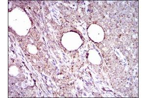 Immunohistochemistry (IHC) image for anti-Aldehyde Dehydrogenase 2 Family (Mitochondrial) (ALDH2) (AA 317-517) antibody (ABIN1724795)