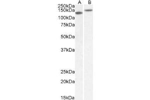 ABIN1781839 (1µg/ml) staining of Mouse (A) and Rat (B) Brain lysate (35µg protein in RIPA buffer). (Contactin 1 抗体  (AA 585-870))