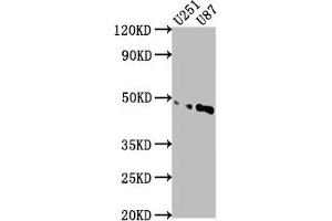 Western Blot Positive WB detected in: U251 whole cell lysate, U87 whole cell lysate All lanes: OTUD3 antibody at 1:1000 Secondary Goat polyclonal to rabbit IgG at 1/50000 dilution Predicted band size: 46 kDa Observed band size: 46 kDa (OTUD3 抗体  (AA 108-398))
