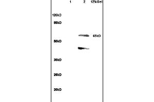 Lane 1: rat heart lysates Lane 2: rat brain lysates probed with Anti SHC3 Polyclonal Antibody, Unconjugated (ABIN715661) at 1:200 in 4 °C. (SHC3 抗体  (AA 501-594))