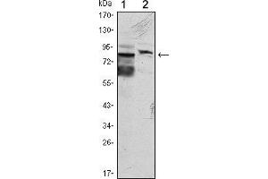 Western blot analysis using KLHL11 mouse mAb against Hela (1) and MCF-7 (2) cell lysate. (KLHL11 抗体)