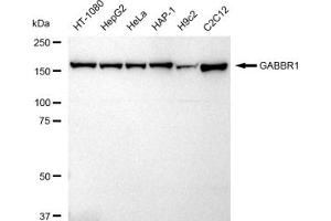 Western blotting analysis using GABBR1 antibody (ABIN7798690).
