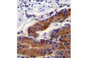 Formalin fixed and paraffin embedded stomach tissue reacted with Whirlin  Antibody  followed by peroxidase conjugation of the secondary antibody and DAB staining. (DFNB31 抗体  (Middle Region))