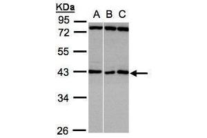 WB Image Sample(30 ug whole cell lysate) A:A431, B:HeLa S3, C:Hep G2 , 10% SDS PAGE antibody diluted at 1:1000 (ASB5 抗体)