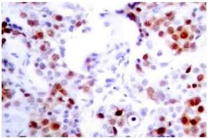 Image no. 1 for anti-Activating Transcription Factor 2 (ATF2) antibody (ABIN265319) (ATF2 抗体)