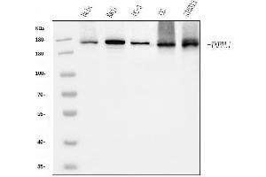 Western blot analysis of INPPL1 using anti-INPPL1 antibody (ABIN7599785).