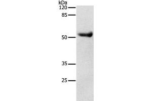 Western Blot analysis of Human liver cancer tissue using DRD4 Polyclonal Antibody at dilution of 1:600 (DRD4 抗体)