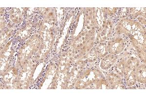 Detection of CRYl1 in Human Kidney Tissue using Monoclonal Antibody to Crystallin Lambda 1 (CRYl1) (CRYL1 抗体  (AA 1-319))