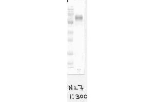 Image no. 1 for anti-Cytochrome B-245, beta Polypeptide (CYBB) antibody (ABIN1042598) (CYBB 抗体)