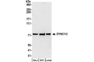 Western Blotting (WB) image for anti-Dynein, Cytoplasmic 1, Intermediate Chain 2 (DYNC1I2) (AA 1-50) antibody (ABIN7455045)