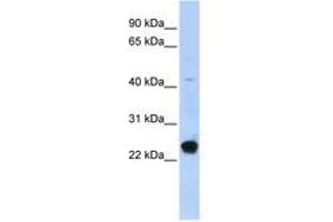 Image no. 1 for anti-Chromosome 16 Open Reading Frame 80 (C16orf80) (AA 71-120) antibody (ABIN6740375) (C16orf80 抗体  (AA 71-120))