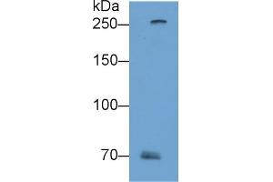 Detection of FLG2 in A431 cell lysate using Polyclonal Antibody to Filaggrin 2 (FLG2) (FLG2 抗体  (AA 1222-1368))