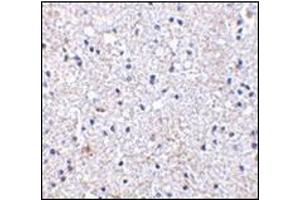 Immunohistochemistry of SCO1 in human brain tissue with this product at 2. (SCO1 抗体  (Center))