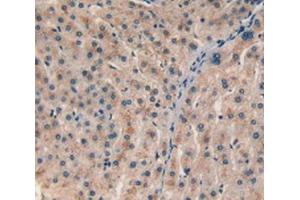 IHC-P analysis of Human Liver Tissue, with DAB staining. (CHI3L1 抗体  (AA 112-377))