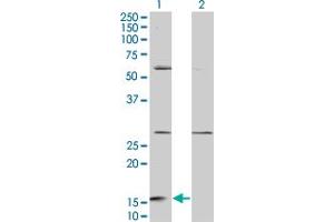 Western Blot analysis of GHRL expression in transfected 293T cell line by GHRL monoclonal antibody (M08), clone 3B8. (Ghrelin 抗体  (AA 1-117))