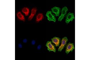 ABIN6264770 and ABIN6273310 staining Hela cells by IF/ICC. (RLBP1 抗体  (Internal Region))