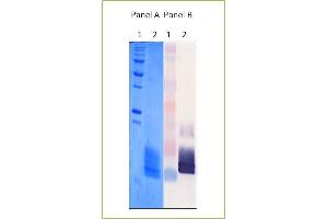 Image no. 1 for Tissue Factor Pathway Inhibitor 2 (TFPI2) protein (His tag) (ABIN573781)